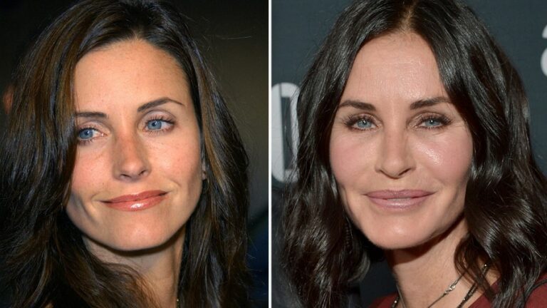 Has Courteney Cox Had Plastic Surgery? What Was Her Early Life?