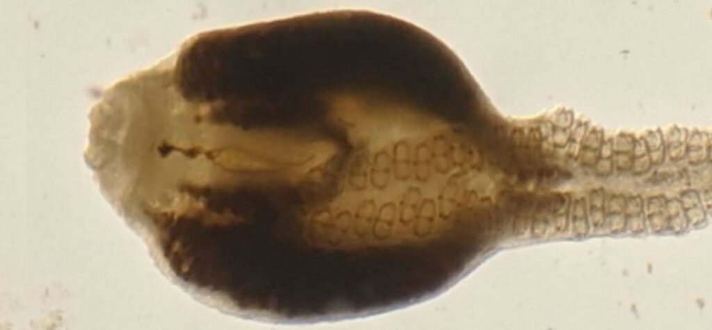 The World's Biggest Study On Parasites Has Found Something Terrible. They're Dying. 3