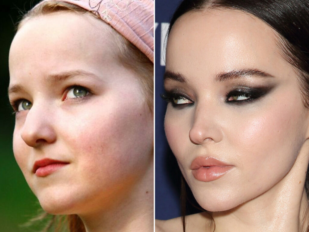 Does Dove Cameron Have Plastic Surgery?