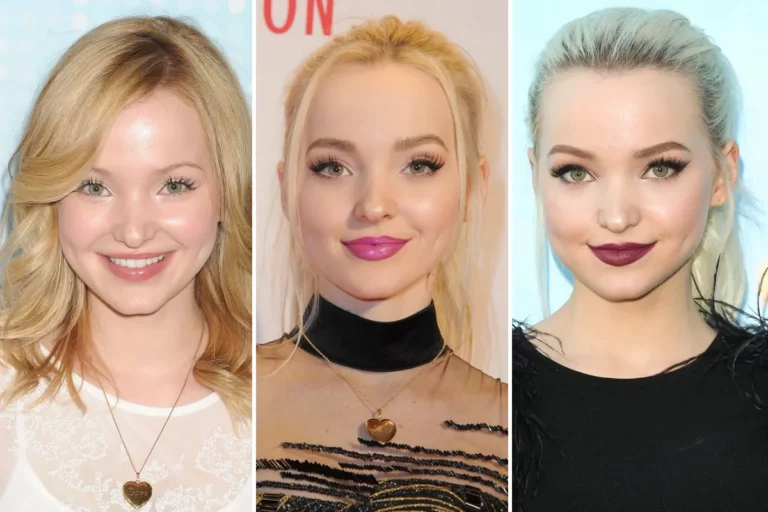 Dove Cameron Before Plastic Surgery; Disney Kid Then And Now!